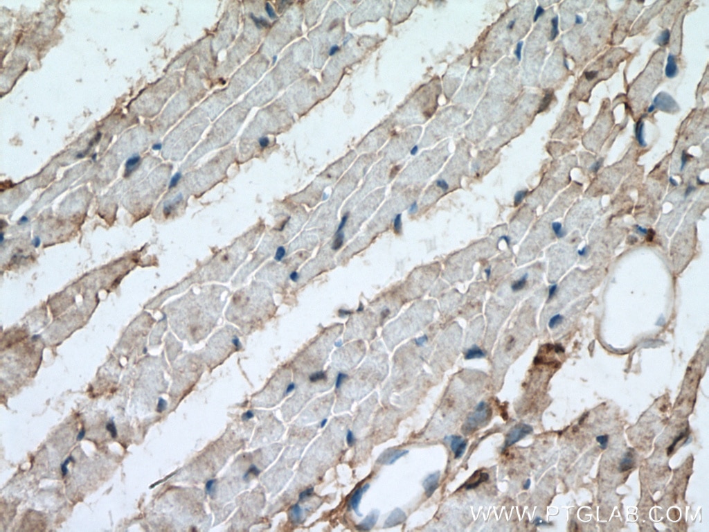 Immunohistochemistry (IHC) staining of mouse heart tissue using PYGB Polyclonal antibody (55380-1-AP)