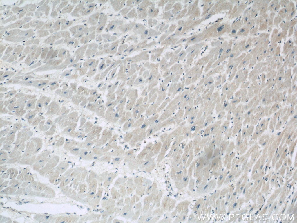 Immunohistochemistry (IHC) staining of human heart tissue using PYGB Polyclonal antibody (55380-1-AP)