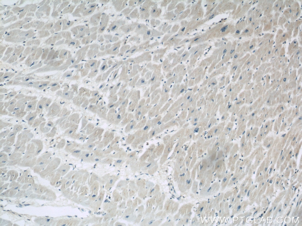 IHC staining of human heart using 55380-1-AP