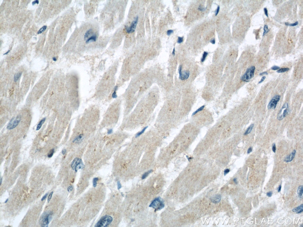IHC staining of human heart using 55380-1-AP