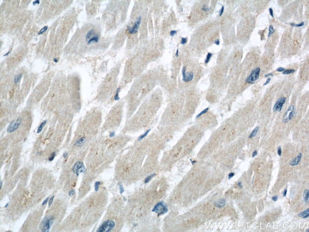 Immunohistochemistry (IHC) staining of human heart tissue using PYGB Polyclonal antibody (55380-1-AP)