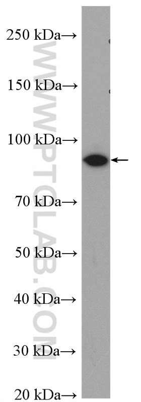 WB analysis of U-251 using 55380-1-AP