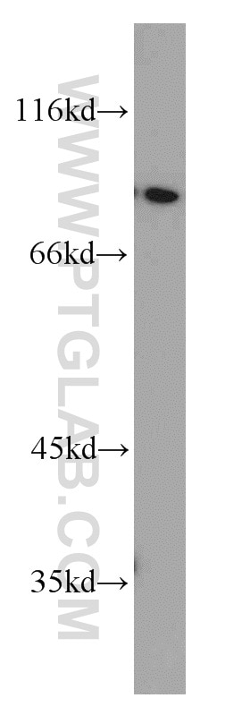 WB analysis of HeLa using 55380-1-AP