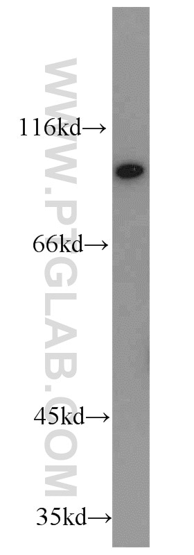 Western Blot (WB) analysis of MCF-7 cells using PYGB Polyclonal antibody (55380-1-AP)