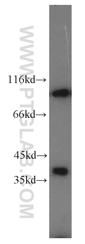 Western Blot (WB) analysis of A549 cells using PYGB Polyclonal antibody (55380-1-AP)