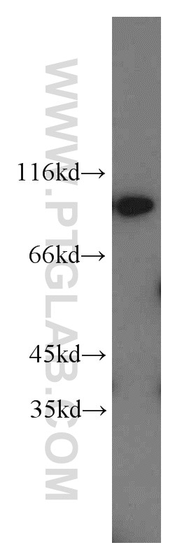Western Blot (WB) analysis of A549 cells using PYGB Polyclonal antibody (55380-1-AP)