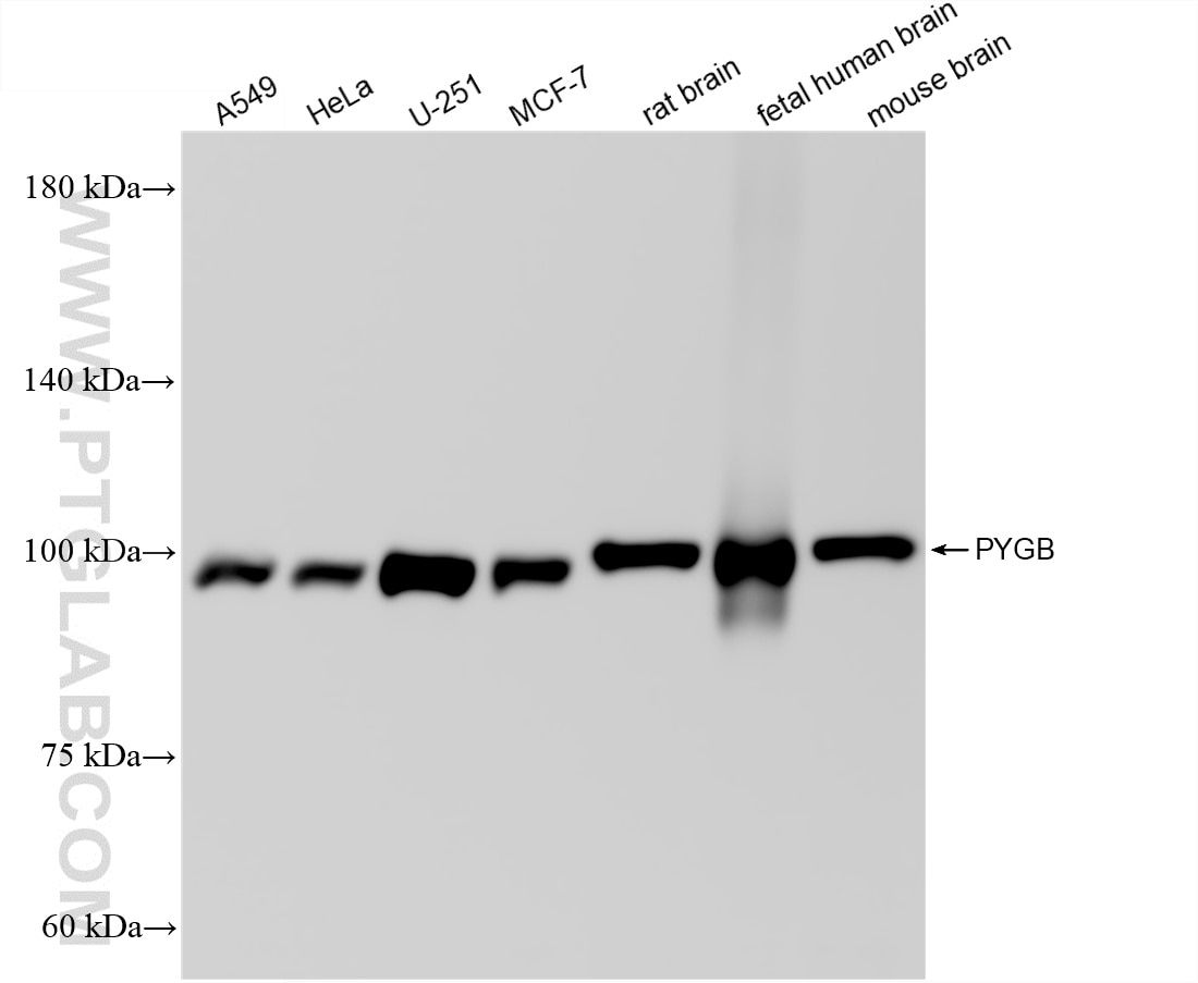 Western Blot (WB) analysis of various lysates using PYGB Recombinant monoclonal antibody (86737-3-RR)