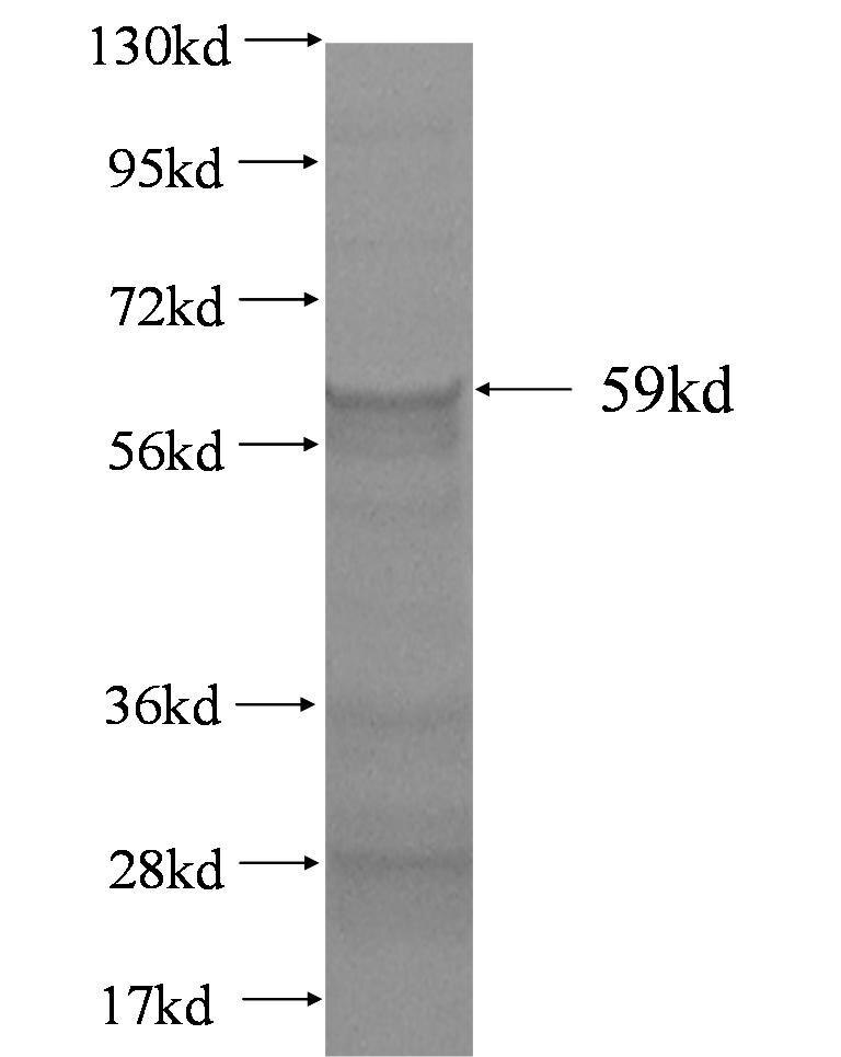 PYGB fusion protein Ag2732 SDS-PAGE