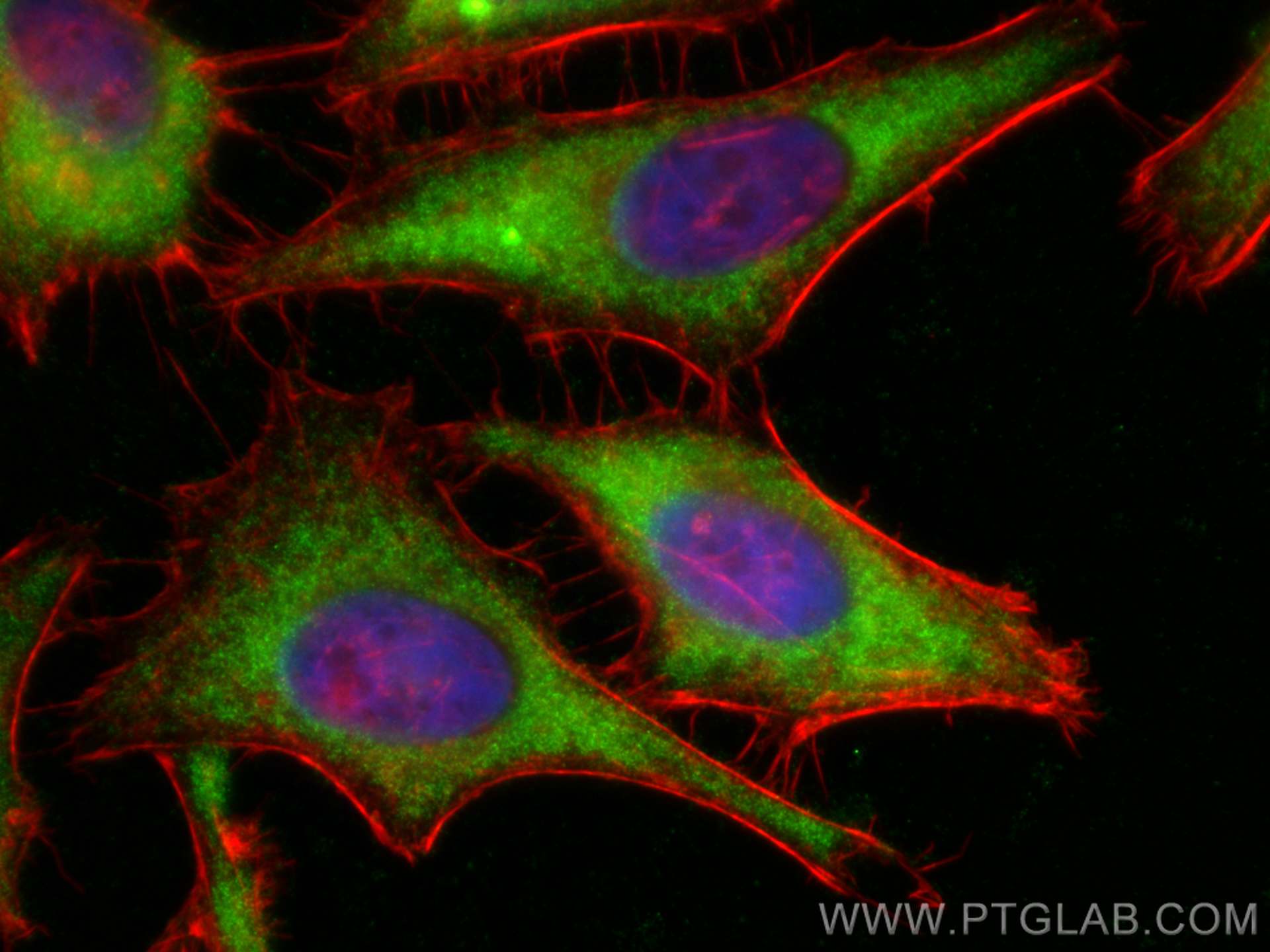 Immunofluorescence (IF) / fluorescent staining of HeLa cells using PYGL Polyclonal antibody (15851-1-AP)