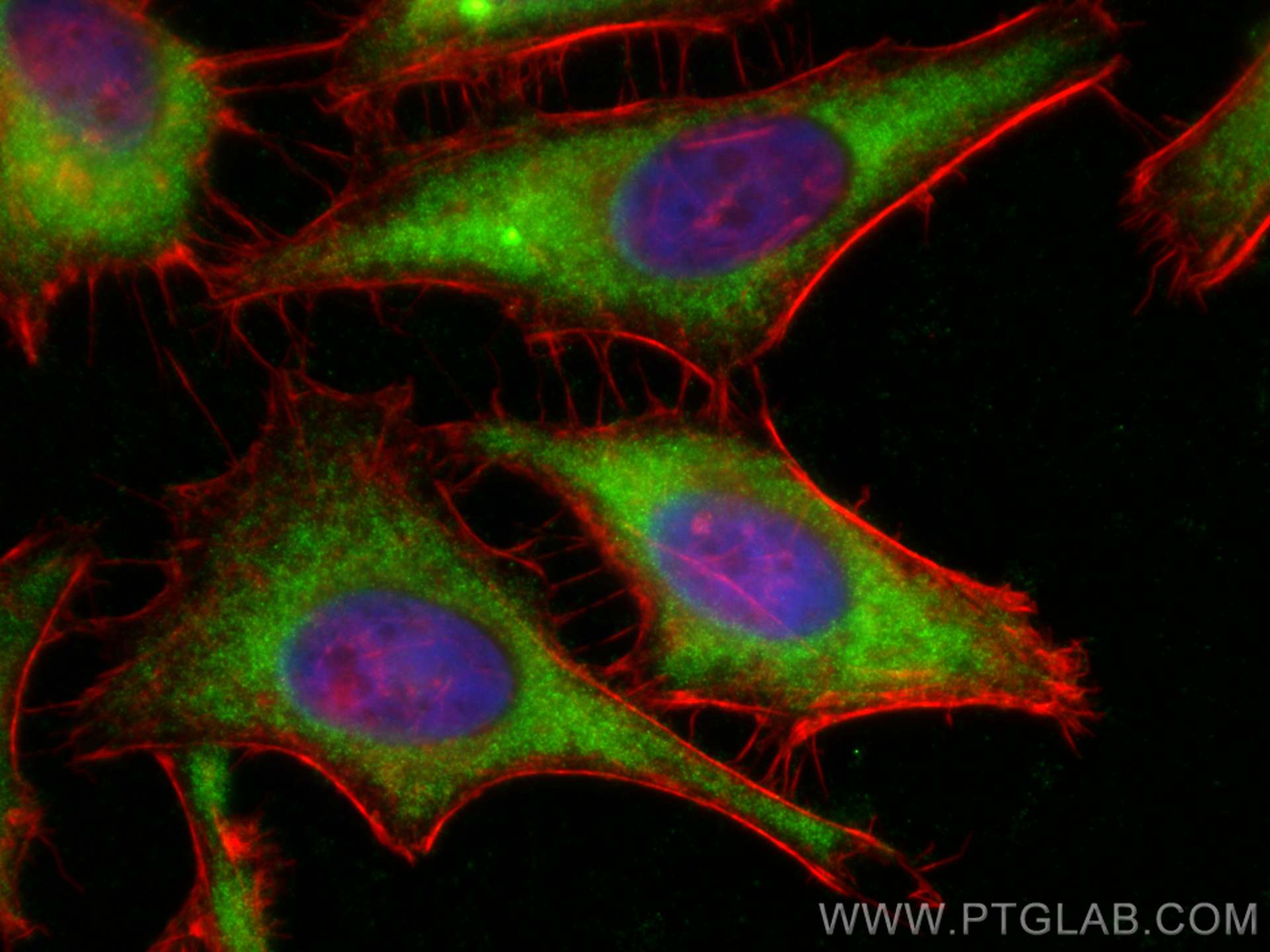 IF Staining of HeLa using 15851-1-AP