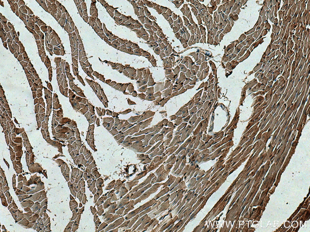 Immunohistochemistry (IHC) staining of mouse heart tissue using PYGL Polyclonal antibody (15851-1-AP)
