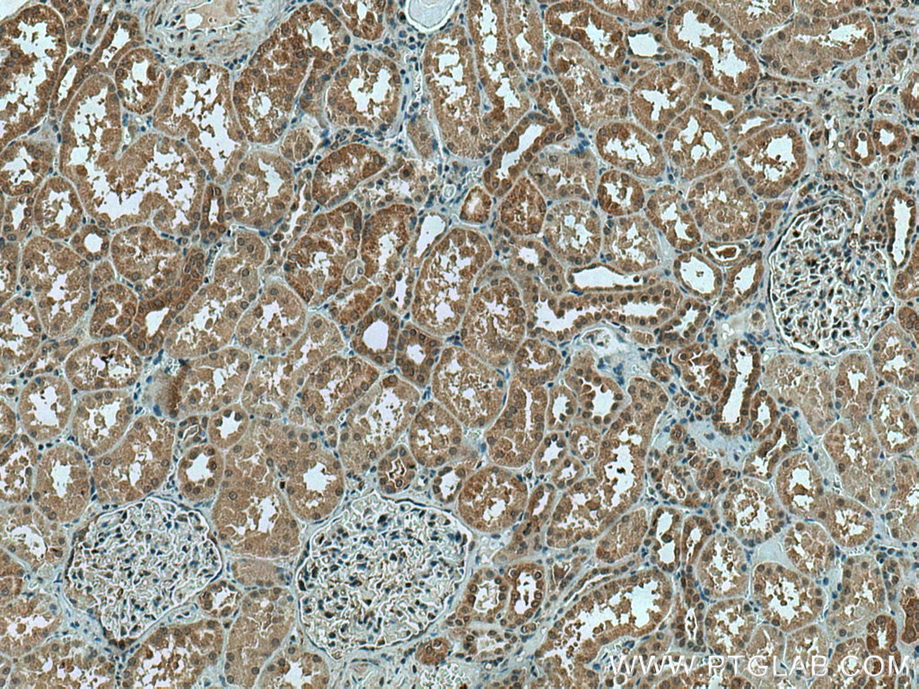 Immunohistochemistry (IHC) staining of human kidney tissue using PYGL Polyclonal antibody (15851-1-AP)