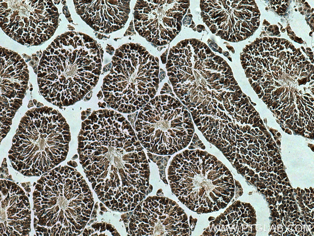 Immunohistochemistry (IHC) staining of mouse testis tissue using PYGL Polyclonal antibody (15851-1-AP)
