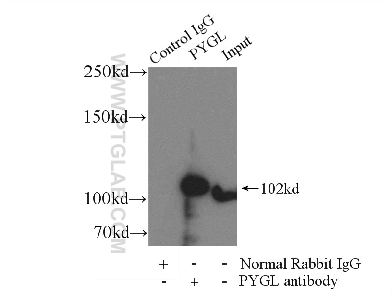 Immunoprecipitation (IP) experiment of mouse liver tissue using PYGL Polyclonal antibody (15851-1-AP)