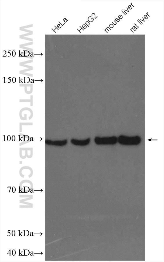 Western Blot (WB) analysis of various lysates using PYGL Polyclonal antibody (15851-1-AP)