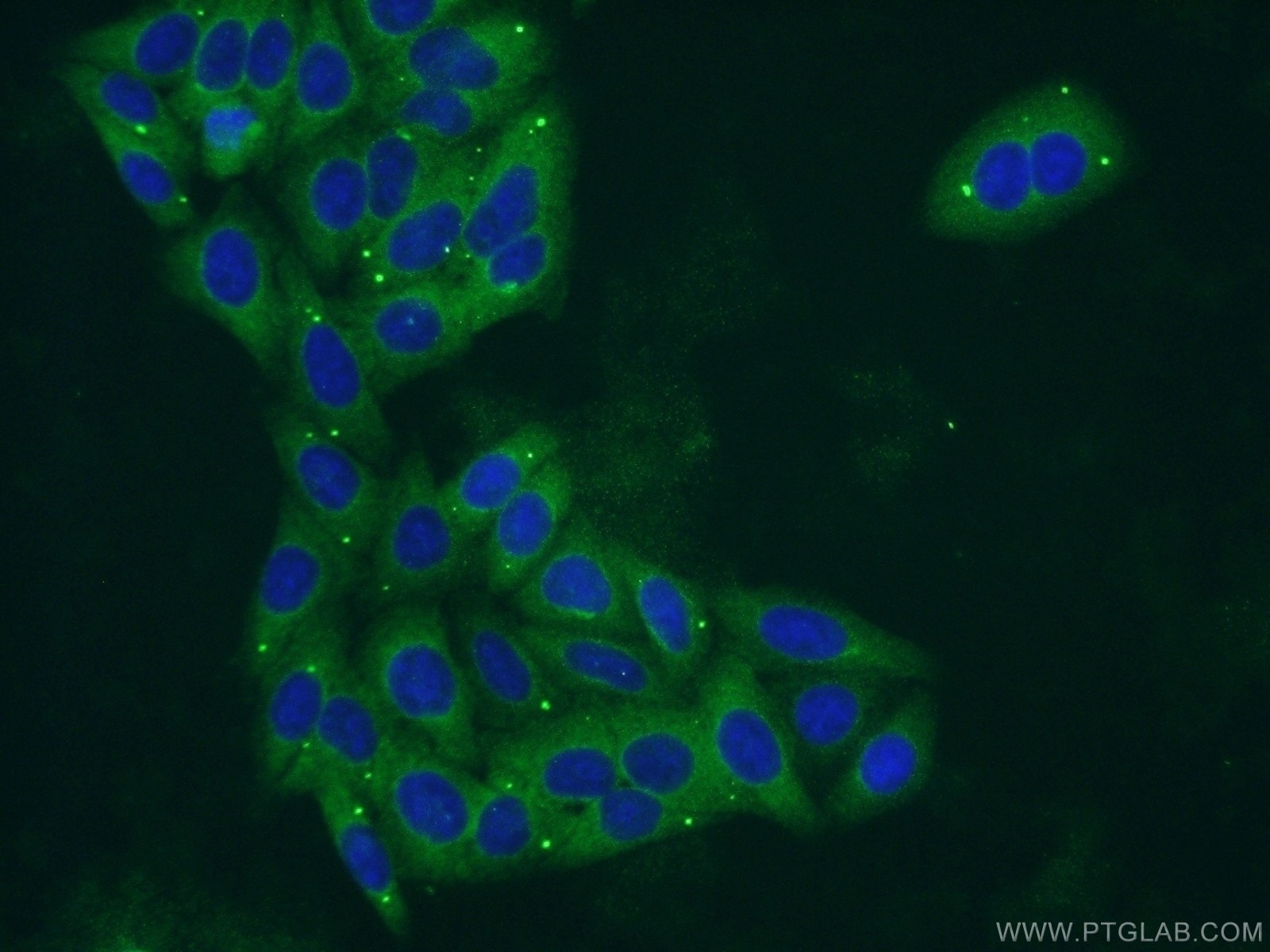 Immunofluorescence (IF) / fluorescent staining of HepG2 cells using PYGL Polyclonal antibody (55429-1-AP)