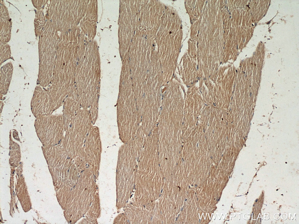 Immunohistochemistry (IHC) staining of human skeletal muscle tissue using PYGL Polyclonal antibody (55429-1-AP)