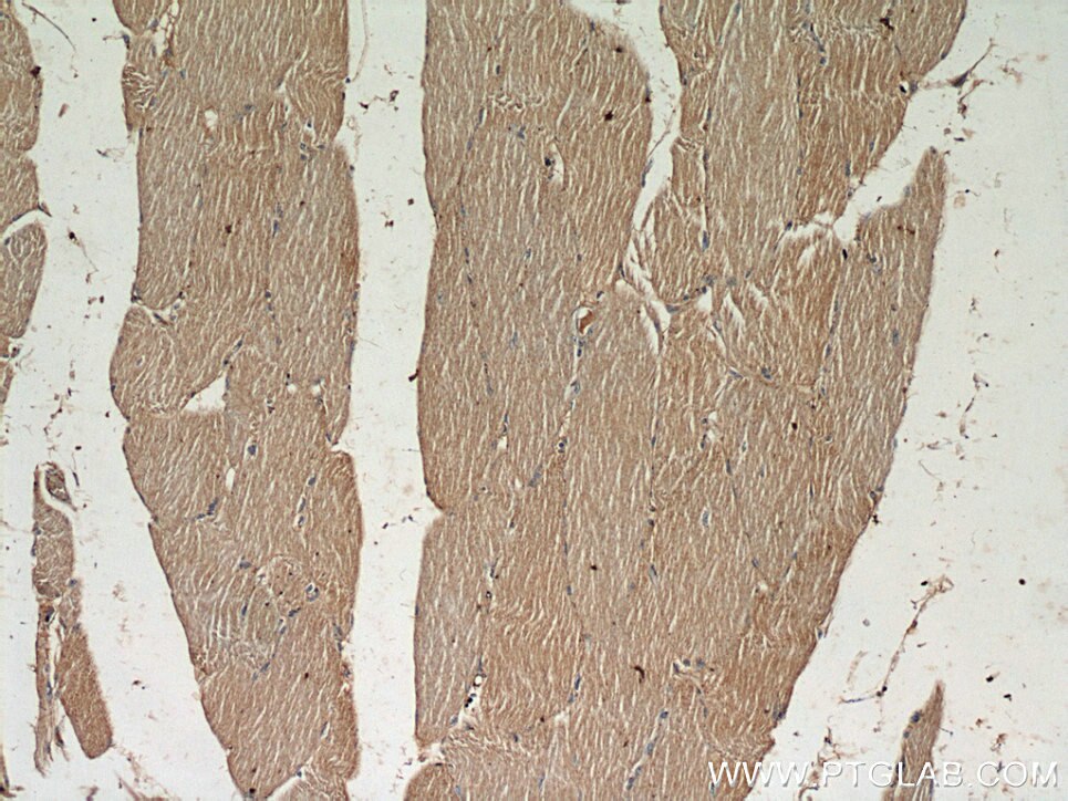 Immunohistochemistry (IHC) staining of human skeletal muscle tissue using PYGL Polyclonal antibody (55429-1-AP)