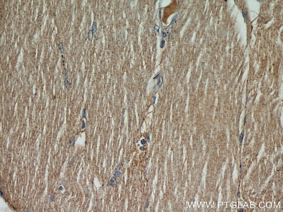 IHC staining of human skeletal muscle using 55429-1-AP