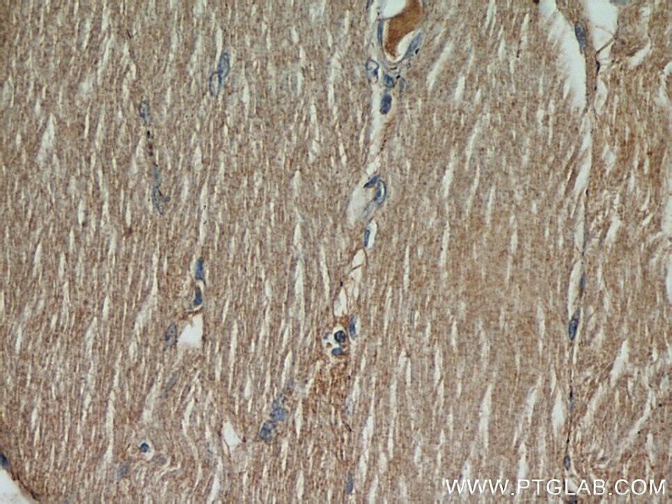 Immunohistochemistry (IHC) staining of human skeletal muscle tissue using PYGL Polyclonal antibody (55429-1-AP)