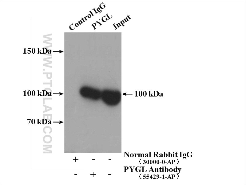 Immunoprecipitation (IP) experiment of HepG2 cells using PYGL Polyclonal antibody (55429-1-AP)