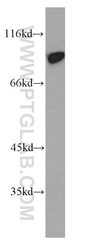Western Blot (WB) analysis of HeLa cells using PYGL Polyclonal antibody (55429-1-AP)