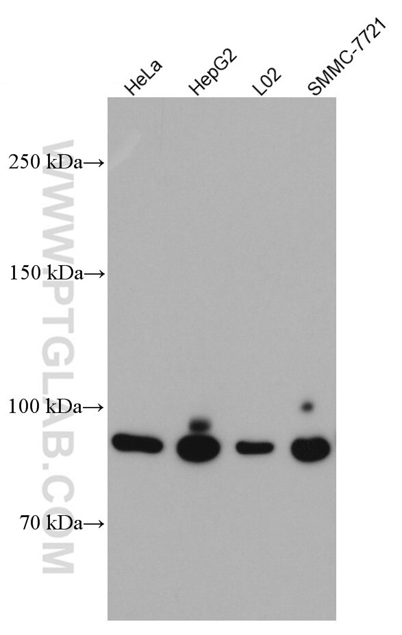 Western Blot (WB) analysis of various lysates using PYGL Monoclonal antibody (66769-1-Ig)