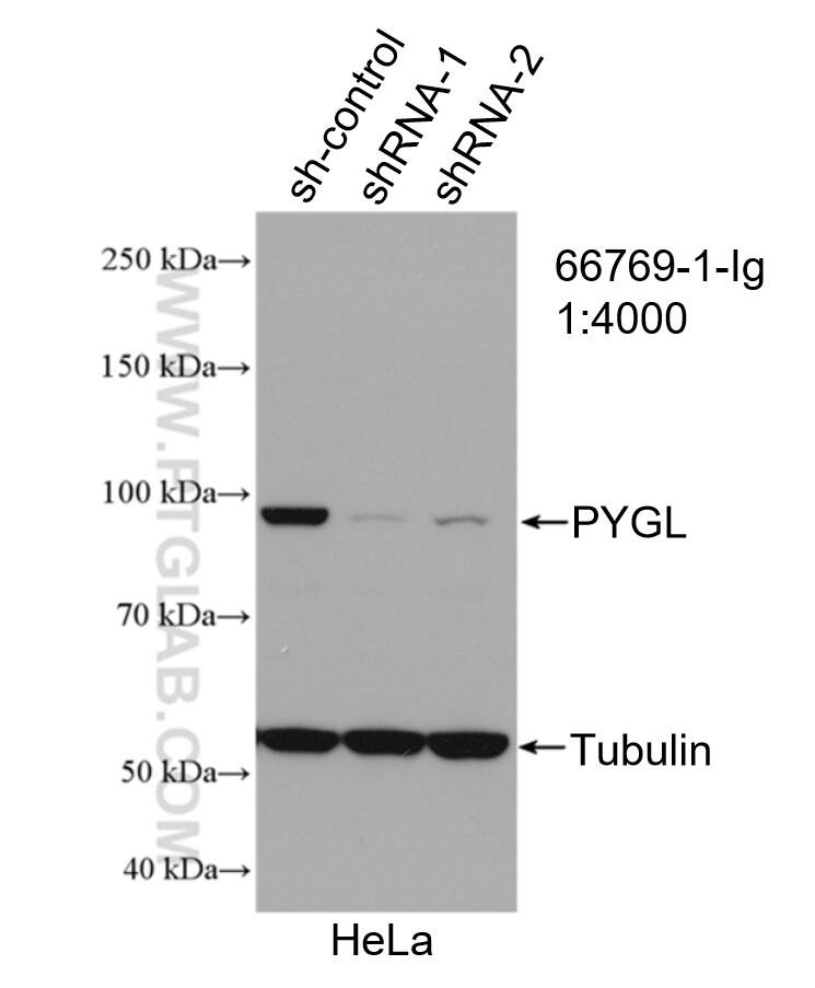 Western Blot (WB) analysis of HeLa cells using PYGL Monoclonal antibody (66769-1-Ig)
