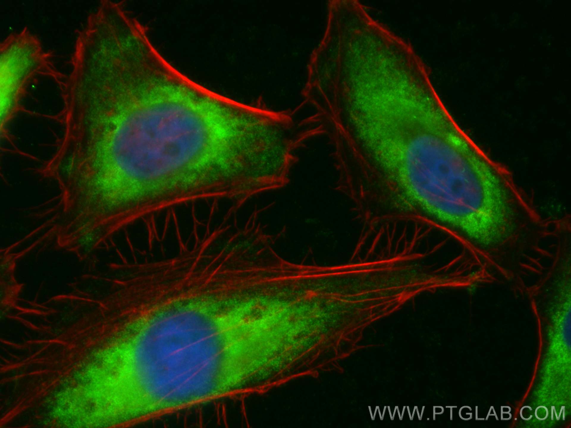 Immunofluorescence (IF) / fluorescent staining of HeLa cells using CoraLite® Plus 488-conjugated PYGL Polyclonal anti (CL488-15851)