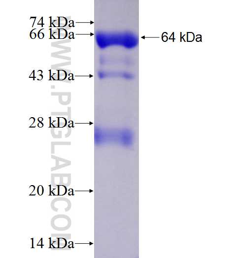 PYGL fusion protein Ag8664 SDS-PAGE