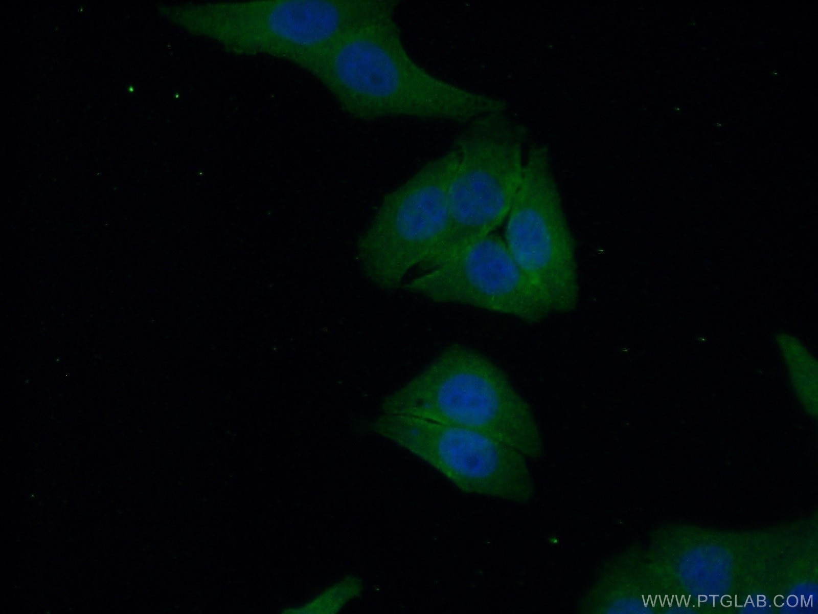 Immunofluorescence (IF) / fluorescent staining of HepG2 cells using PYGM-Specific Polyclonal antibody (19716-1-AP)
