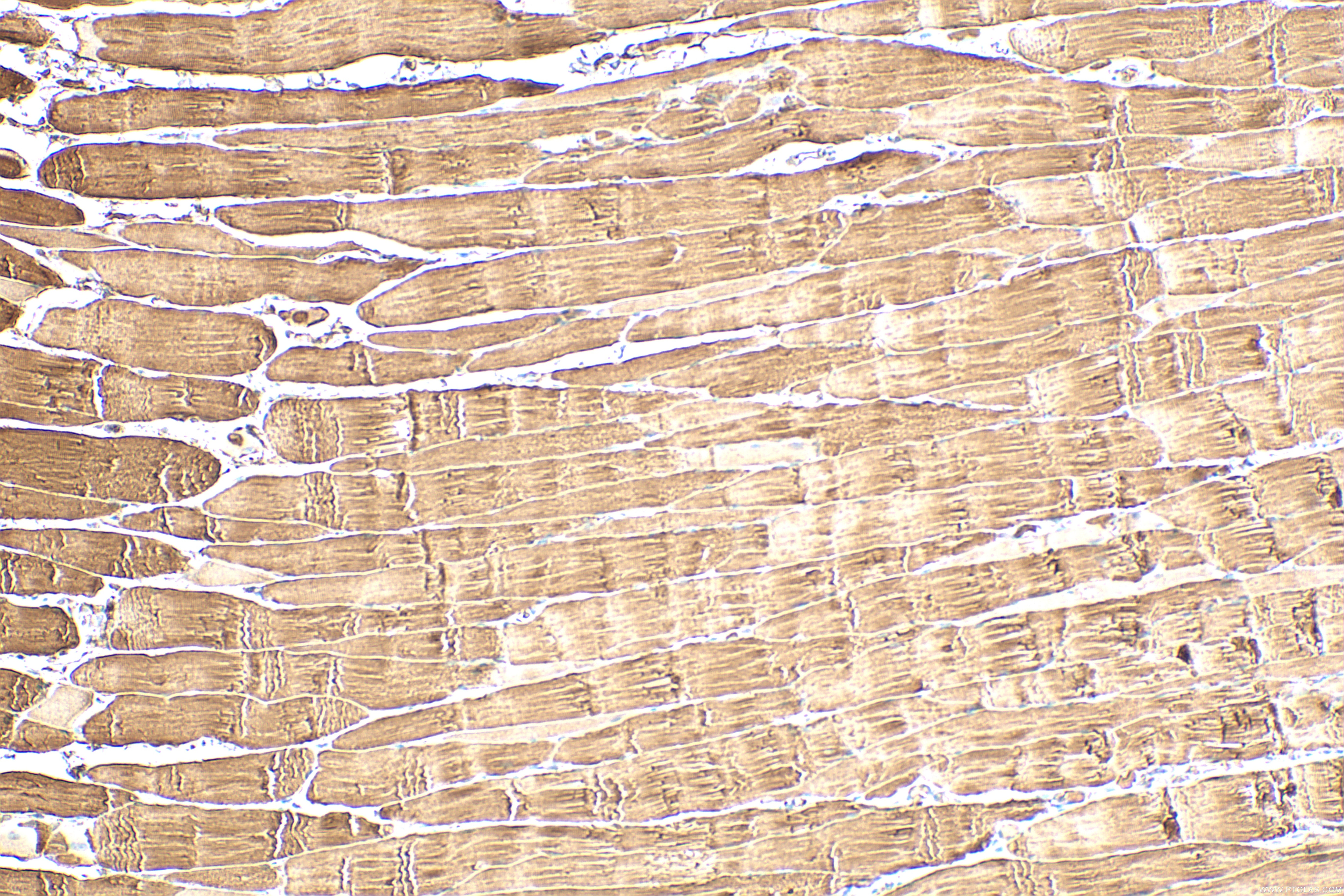 Immunohistochemistry (IHC) staining of rat skeletal muscle tissue using PYGM-Specific Polyclonal antibody (19716-1-AP)