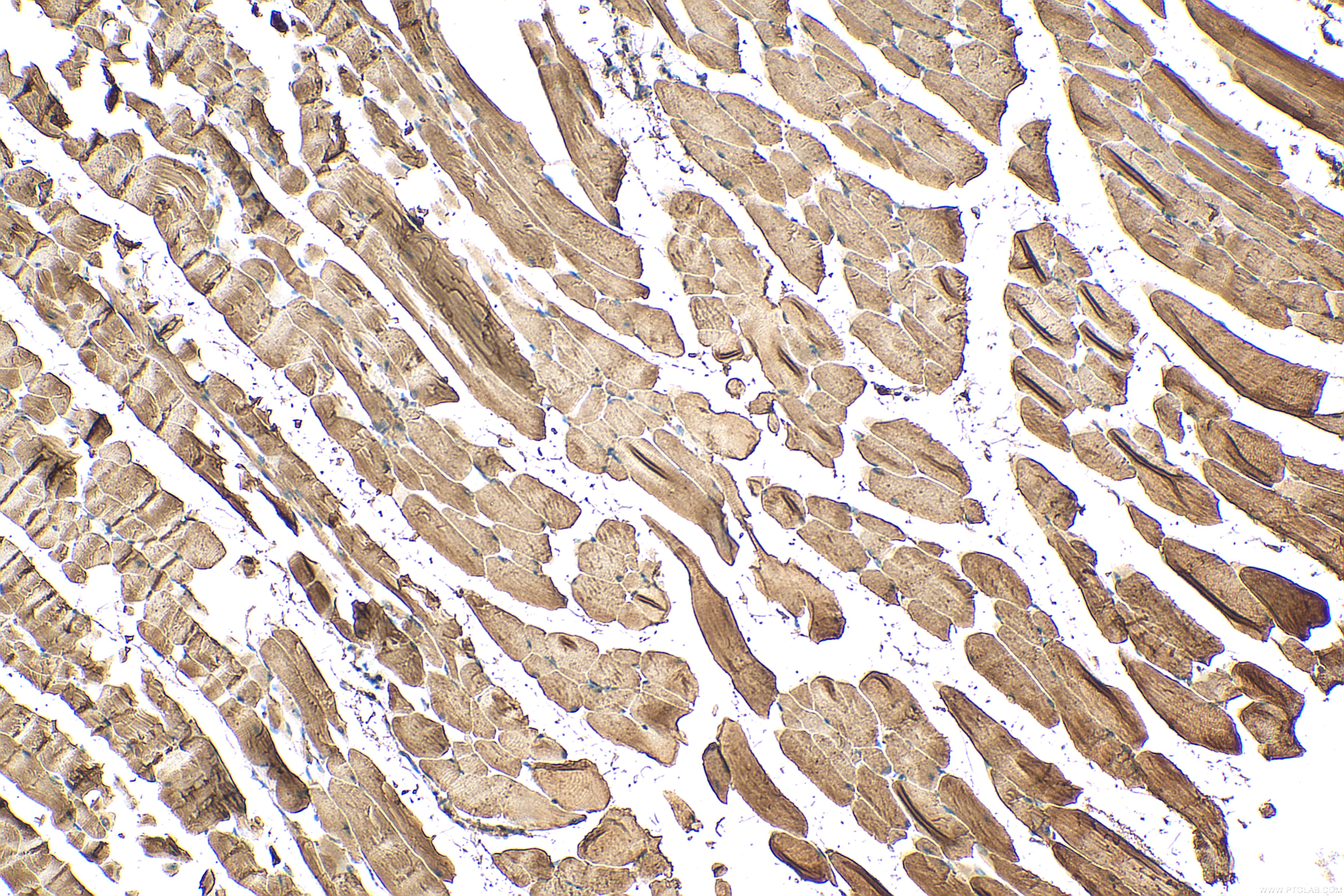 Immunohistochemistry (IHC) staining of mouse skeletal muscle tissue using PYGM-Specific Polyclonal antibody (19716-1-AP)