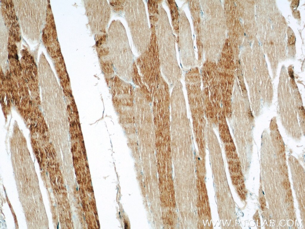 Immunohistochemistry (IHC) staining of human skeletal muscle tissue using PYGM-Specific Polyclonal antibody (19716-1-AP)