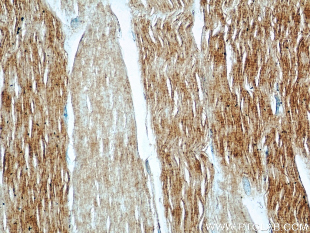 Immunohistochemistry (IHC) staining of human skeletal muscle tissue using PYGM-Specific Polyclonal antibody (19716-1-AP)