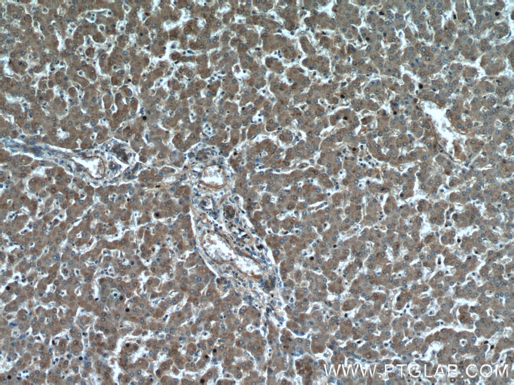 Immunohistochemistry (IHC) staining of human liver tissue using PYGM-Specific Polyclonal antibody (19716-1-AP)