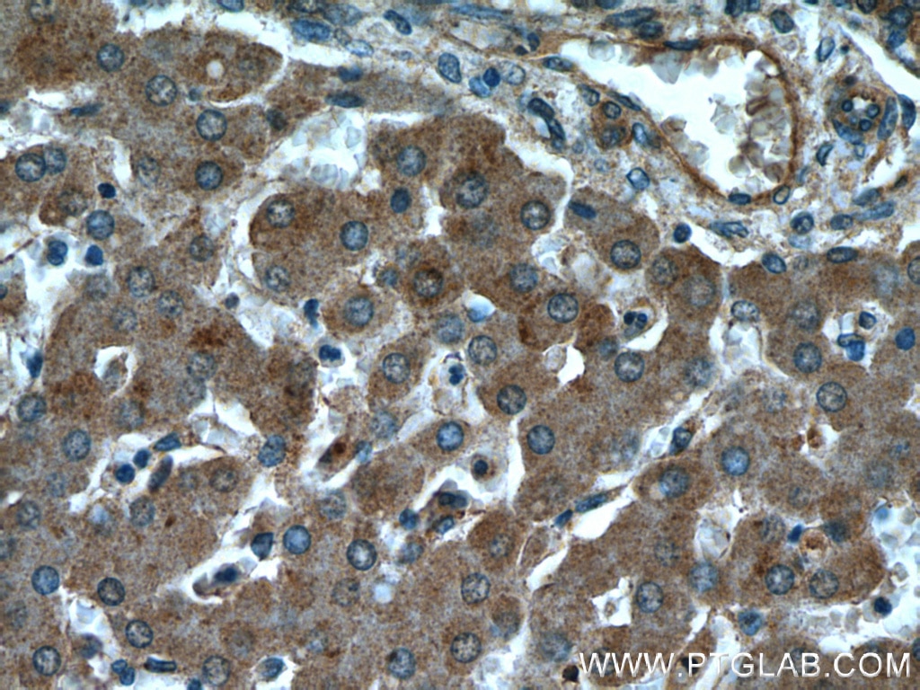 Immunohistochemistry (IHC) staining of human liver tissue using PYGM-Specific Polyclonal antibody (19716-1-AP)