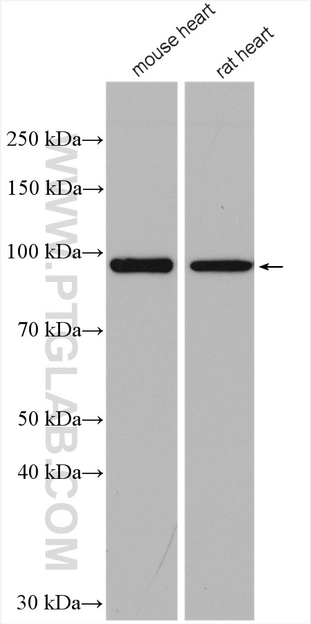 Western Blot (WB) analysis of various lysates using PYGM-Specific Polyclonal antibody (19716-1-AP)