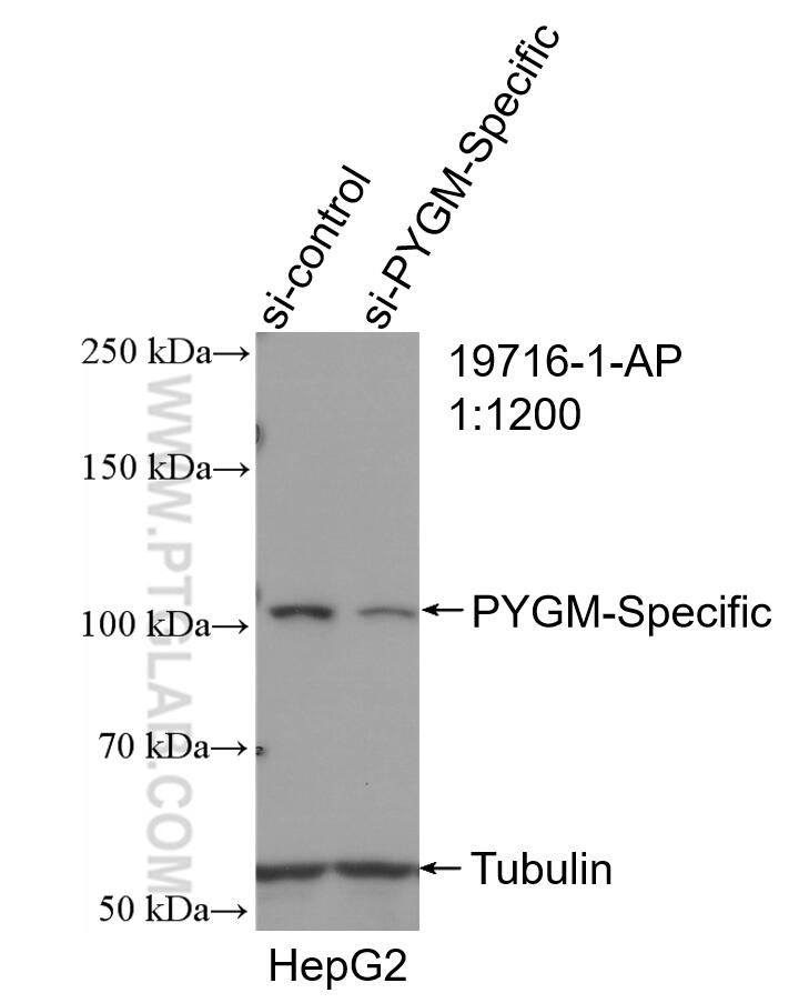 Western Blot (WB) analysis of HepG2 cells using PYGM-Specific Polyclonal antibody (19716-1-AP)