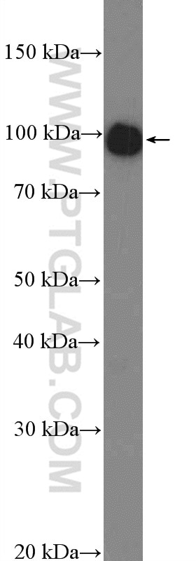 PYGM-Specific Polyclonal antibody