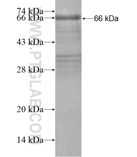 PYGO1 fusion protein Ag18814 SDS-PAGE