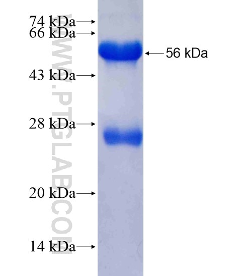 PYGO1 fusion protein Ag18894 SDS-PAGE