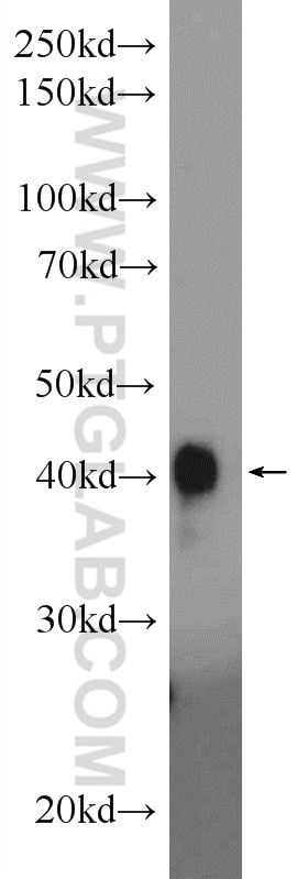 Western Blot (WB) analysis of HeLa cells using PYGO2 Polyclonal antibody (11555-1-AP)