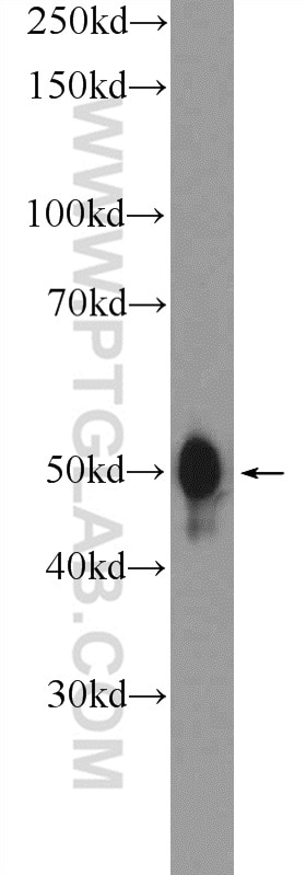 Western Blot (WB) analysis of HeLa cells using PYGO2 Polyclonal antibody (11555-1-AP)