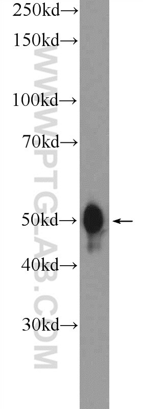 WB analysis of HeLa using 11555-1-AP