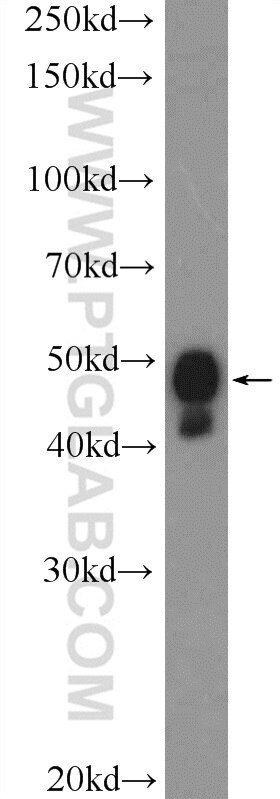 Western Blot (WB) analysis of MDA-MB-453s cells using PYGO2 Polyclonal antibody (11555-1-AP)