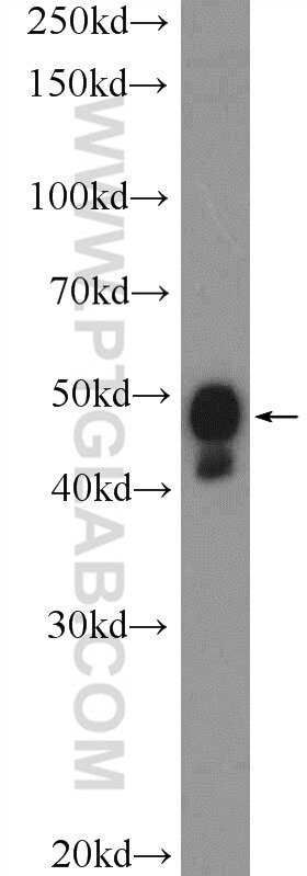 WB analysis of MDA-MB-453s using 11555-1-AP