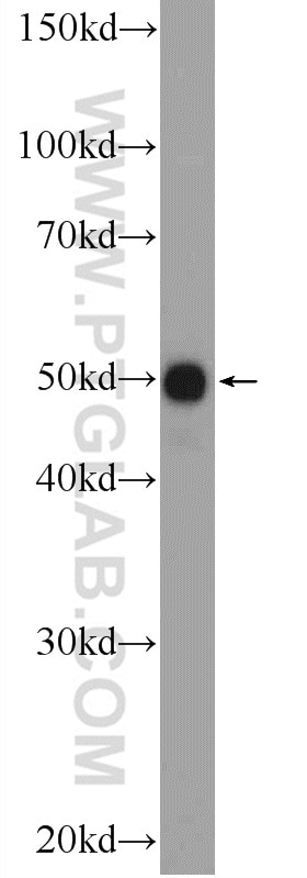 Western Blot (WB) analysis of MDA-MB-453s cells using PYGO2 Polyclonal antibody (11555-1-AP)