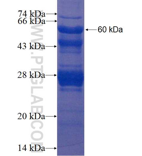 PYGO2 fusion protein Ag2111 SDS-PAGE
