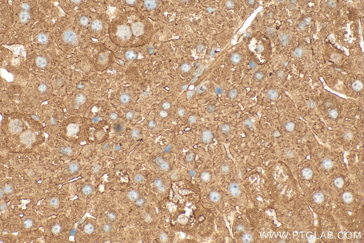 Immunohistochemistry (IHC) staining of mouse liver tissue using PYROXD2 Polyclonal antibody (21845-1-AP)